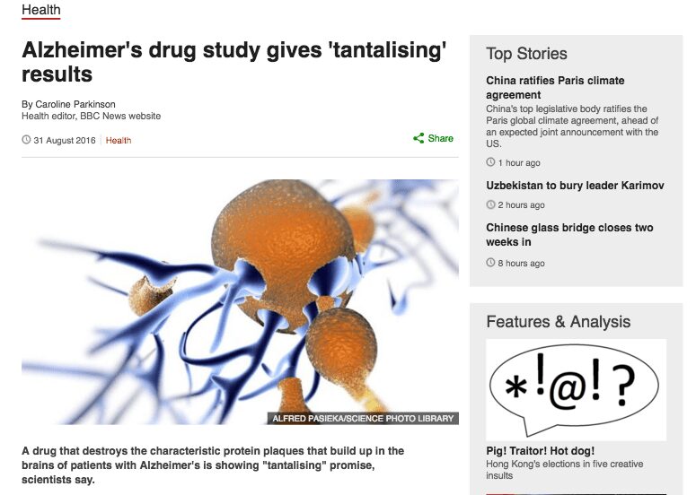 Alzheimer BBC